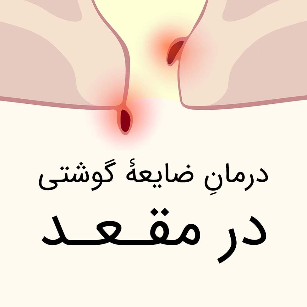 Darmane Zayee Goshti Dar Maghaad